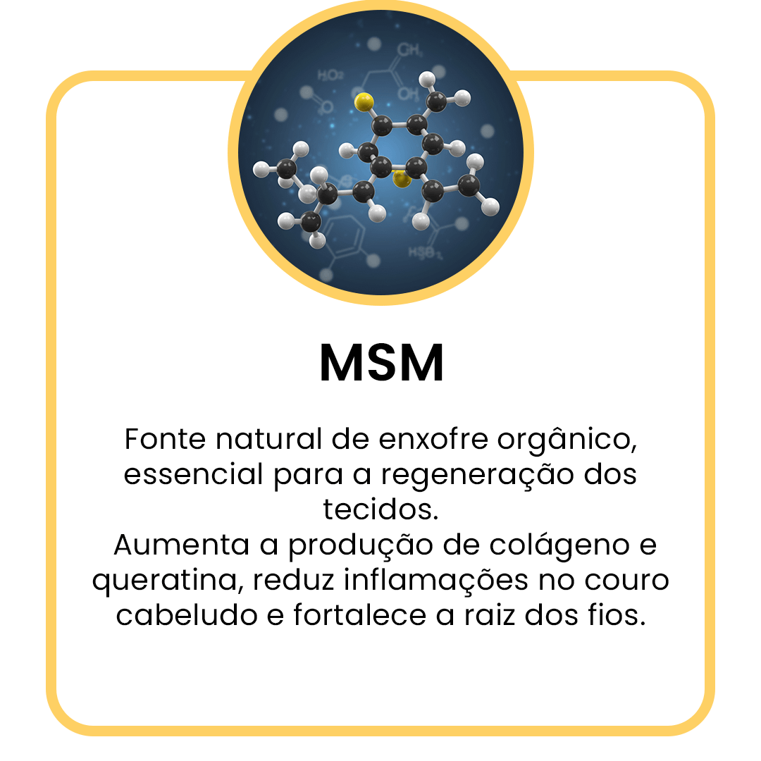 Msm